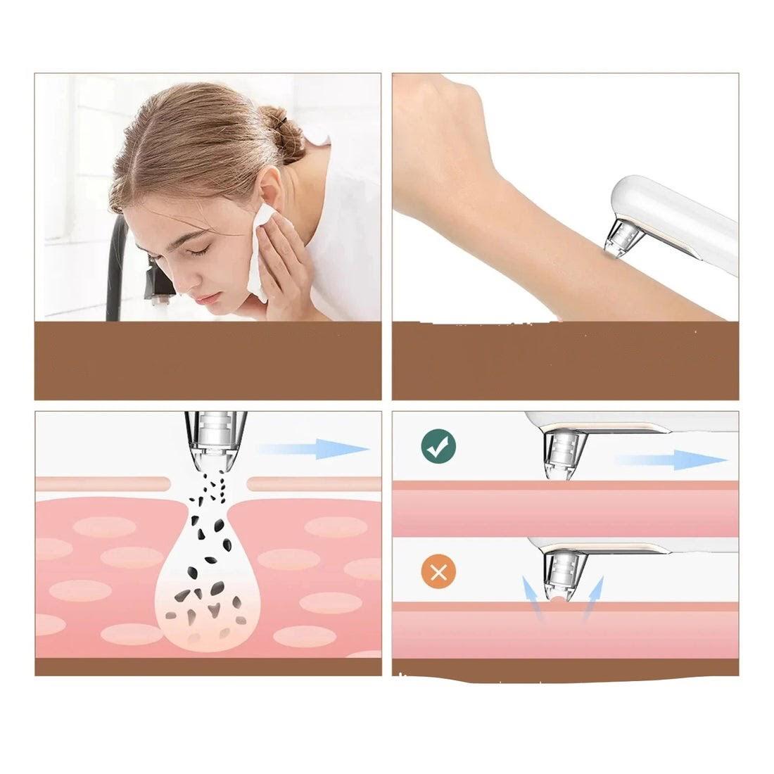 Récupération Peau Femme